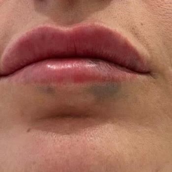 Yanlış Uygulamalar Ve Şüpheli Ürünler Nedeniyle Ciddi Mağduriyet