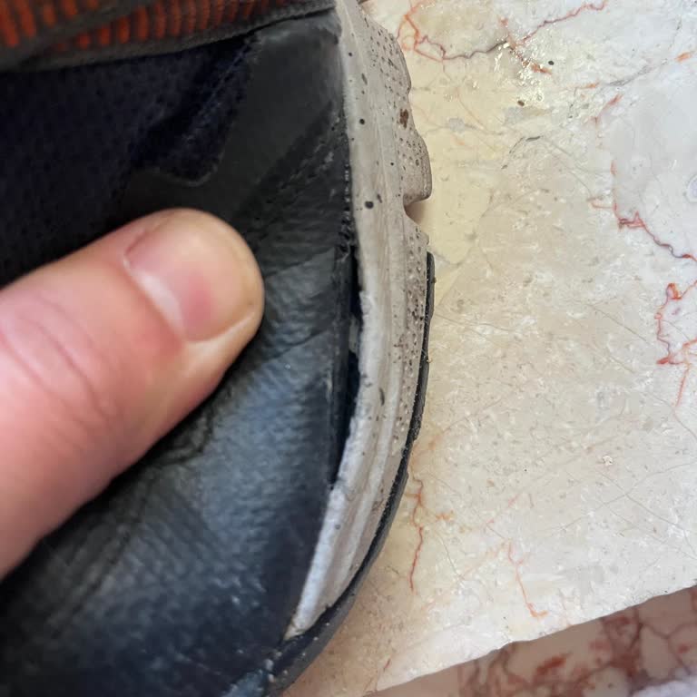 Skechers Ayakkabıda Kısa Sürede Açılma Ve Yetersiz Müşteri Hizmeti