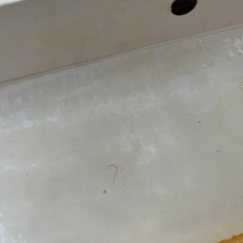 Yemekten Tel Ve Kıl Çıktı Hijyen Ve Sağlık Riski Yaşadım Çözüm Sunulmadı