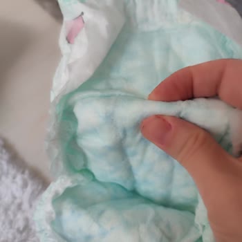 Prima Bebek Bezlerinde Sert Katman Ve Cilt Sorunu: Tüm Paketlerde Aynı Problem