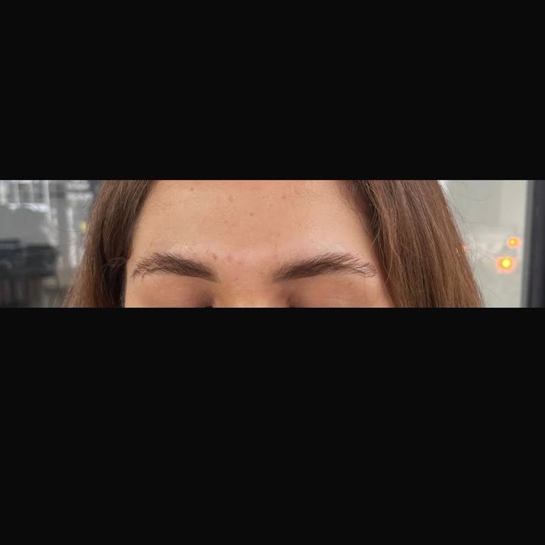 Kaş Lifting İşlemi Sonrası Mağduriyet Ve İlgisizlik