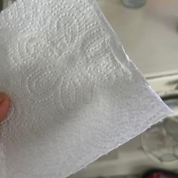 Has Bilican Kelle Paça & Kebap Çorbanın İçinde Erkek Kol Kılı Buldum
