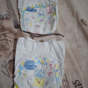 Molfix 1 Numara Bebek Bezinde Sızdırma Ve Boyut Farkı Sorunu