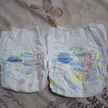 Molfix 1 Numara Bebek Bezinde Sızdırma Ve Boyut Farkı Sorunu