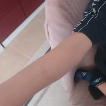 Anaokulu Öğretmeninin Tutumları Ve Okul Yönetiminin İlgisizliği Hakkında Şikayet
