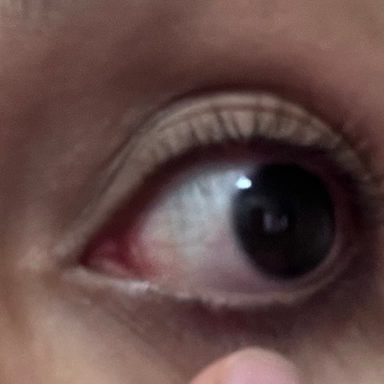 Mağaza Ve Online Satış Arasındaki Fahiş Fiyat Farkı Mağduriyeti