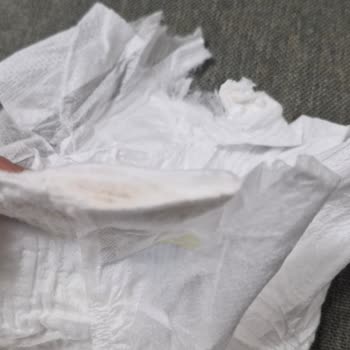 Aldığım Bebek Bezlerinde Üretim Hatasıyla Karşılaştım