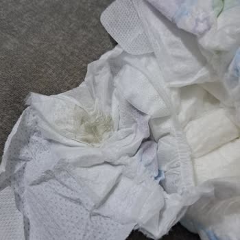 Molfix Bebek Bezinde Sızdırma Ve Hijyen Sorunu Yaşadım