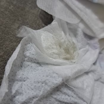 Molfix Bebek Bezinde Sızdırma Ve Hijyen Sorunu Yaşadım