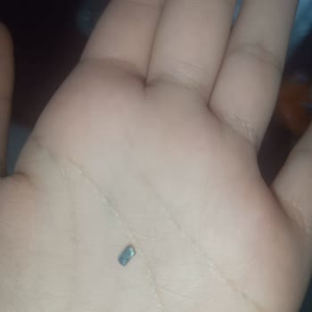 Hazır Gıda Ürününde Yabancı Madde Tespiti Hakkında Şikayet