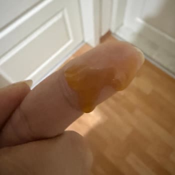 Son Kullanma Tarihi Geçmemiş Serum Bozuk Ve Sızıntılı Çıktı