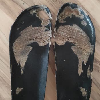 Birkenstock Dört Ayda Parçalanan Terlik Ve Yetersiz Müşteri Hizmeti