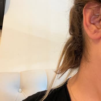 Kuaförde Saçlarım Kaynak İşlemi Sırasında Yandı Mağdur Edildim