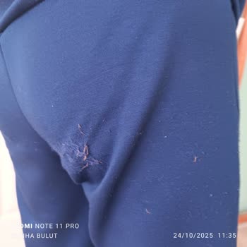 İlk Kullanımda Deforme Olan Takım Elbiseye İade Reddi