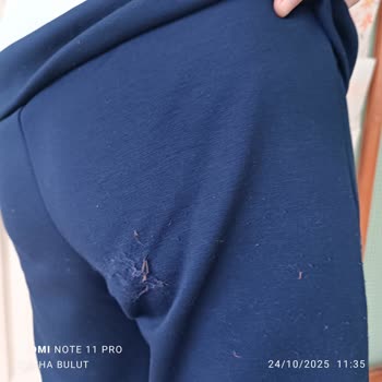 İlk Kullanımda Deforme Olan Takım Elbiseye İade Reddi