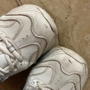 Skechers Ayakkabıda Kısa Sürede Yırtılma Ve Hayal Kırıklığı