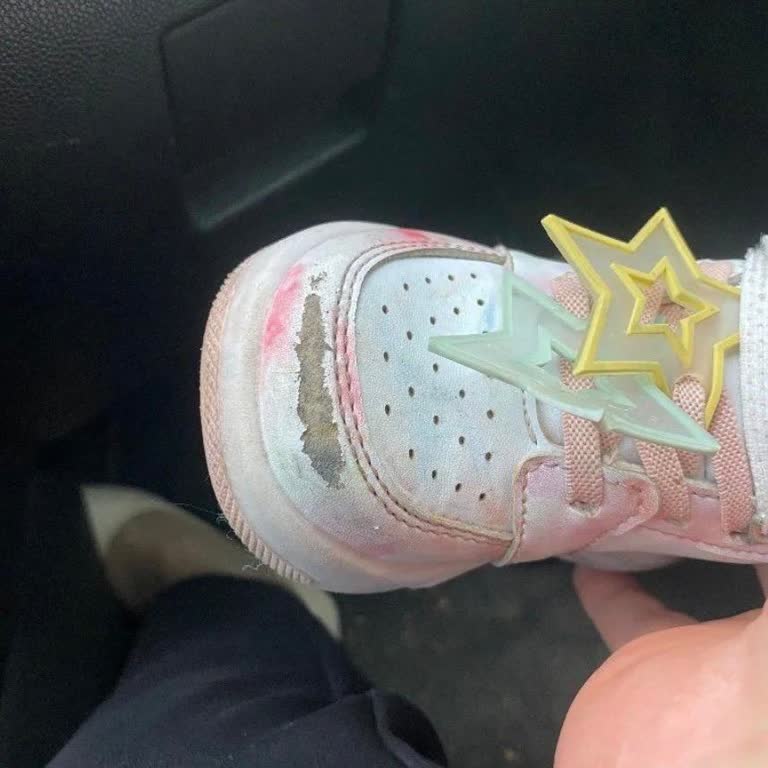 Aldığım Çocuk Botunda Hızlı Deformasyon Ve Garanti Sürecinde Mağduriyet Yaşadım