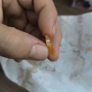 Yemekten Plastik Parça Çıkması Sağlığımı Tehlikeye Attı