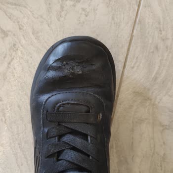 Skechers Ayakkabıda Erken Deformasyon Ve Garanti Reddi Hayal Kırıklığı