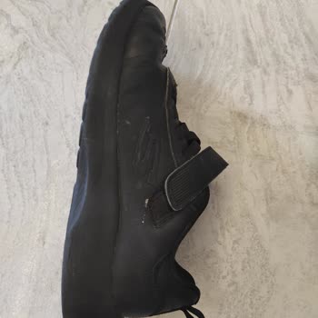 Skechers Ayakkabıda Erken Deformasyon Ve Garanti Reddi Hayal Kırıklığı