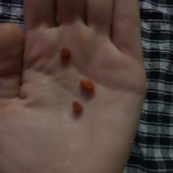 Cips Paketinden Taş Çıkması Nedeniyle Yaşanan Güvenlik Sorunu Ve Mağduriyet