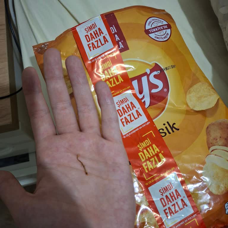 Lays Cips Paketinden Yabancı Madde Çıktı, Sağlık Riski Yaşadım