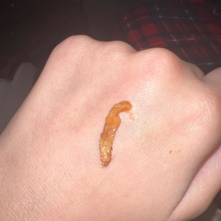 Yemeksepeti Siparişimden Kıl Çıktı, Ücret İadem Yapılmadı