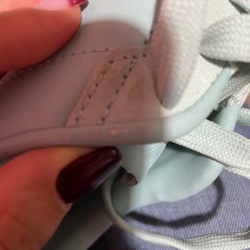 İlk Kullanımda Soyulan Ayakkabı Ve Yetersiz Mağaza Desteği