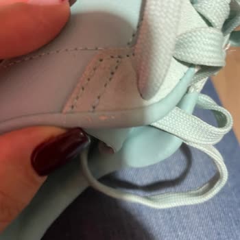 İlk Kullanımda Soyulan Ayakkabı Ve Yetersiz Mağaza Desteği