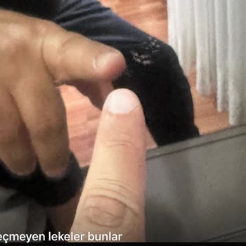 Taşpınar Alışveriş Merkezleri Teslimatta Kusurlu Ürün Ve İletişim Sorunu: Çözüm Bekliyorum
