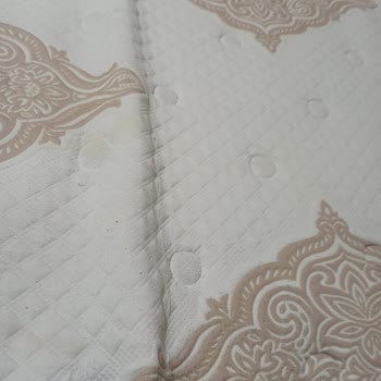 Yatakta Deformasyon Ve Çözüm Sunmayan Servis Mağduriyeti