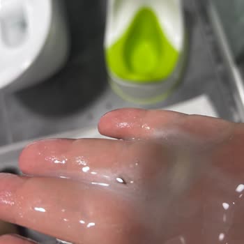 Şampuanın İçinden Böcek Çıktı, Şok Oldum!