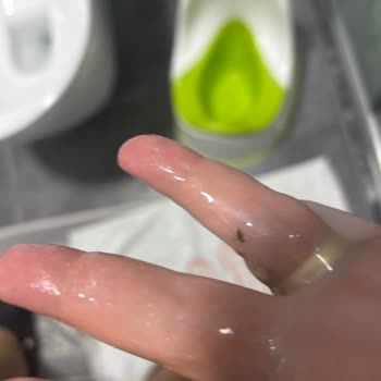 Şampuanın İçinden Böcek Çıktı, Şok Oldum!