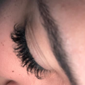 Güzellik Merkezi Kirpik Uygulaması Sonrası Yaşanan Sorun