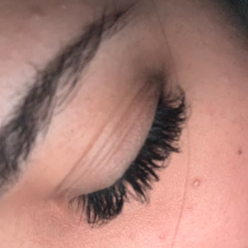 Güzellik Merkezi Kirpik Uygulaması Sonrası Yaşanan Sorun