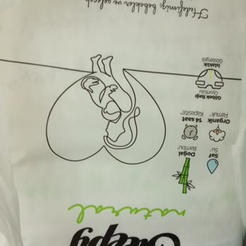 Aldığım Bebek Bezleri Bebeğimde Pişik Ve Ağrıya Sebep Oldu