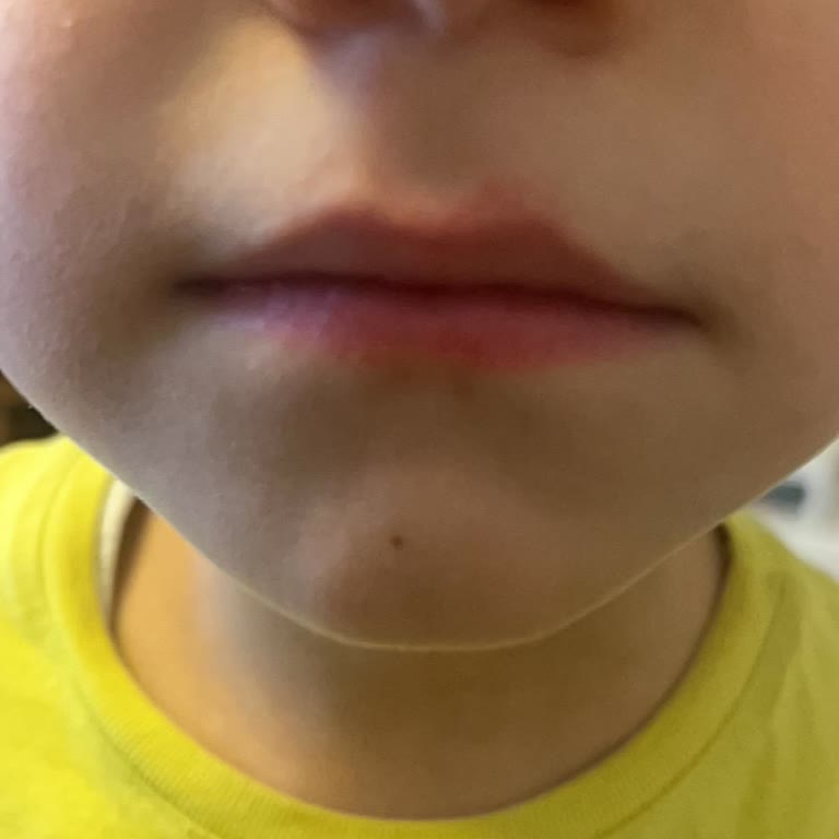 Mustela Nourishing Stick'in Haznesi Kırıldı, Çocuğumun Cildinde Tahrişe Neden Oldu