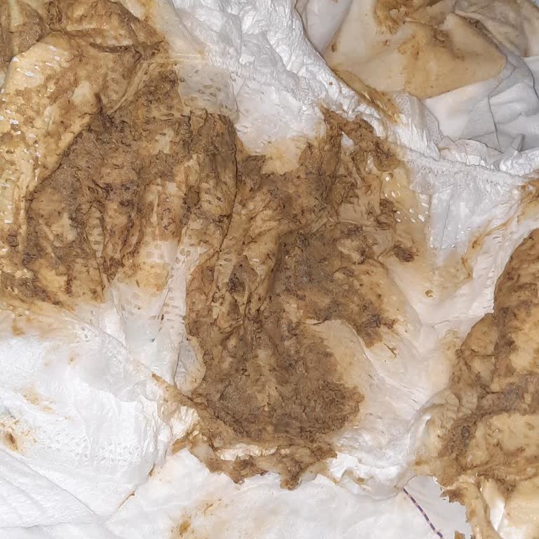 Aldığım Aptamil 4 Devam Sütü Kızımda İshal Ve Kusmaya Sebep Oldu