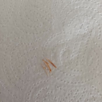 Erpiliç Nugget İçinden Sert Cisim Çıktı, Sağlığımız Tehlikeye Girdi