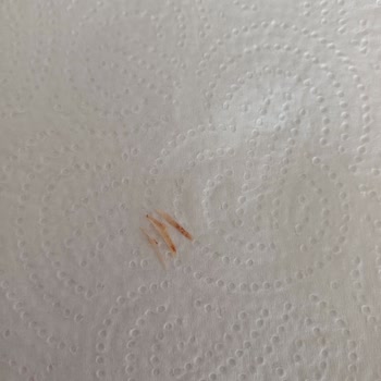 Erpiliç Nugget İçinden Sert Cisim Çıktı, Sağlığımız Tehlikeye Girdi