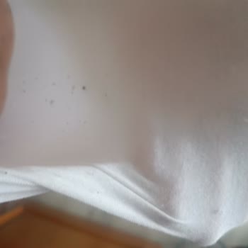 Kısa Sürede Deforme Olan Atletler Ve Para İadesi Talebi