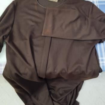 Kuru Temizleme Sonrası Ürün Hasarı ve Mağduriyet Hakkında Şikayet