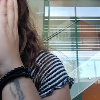 Lazerle Dövme Silme İşleminde Sonuçsuzluk Ve İlgisiz Yaklaşım