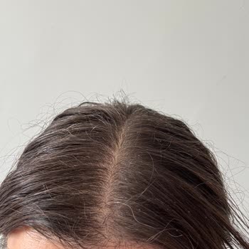 Bioblas Şampuan Saç Dökülmesini Azaltmadı, Kaşıntı Ve Kepek Yaptı