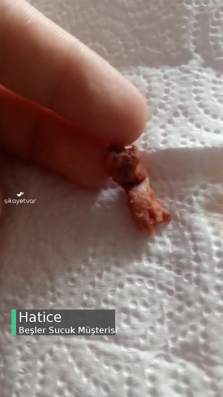 Beşler Sucuktan Tavuk Ayağı Çıktı videonun kapak resmi