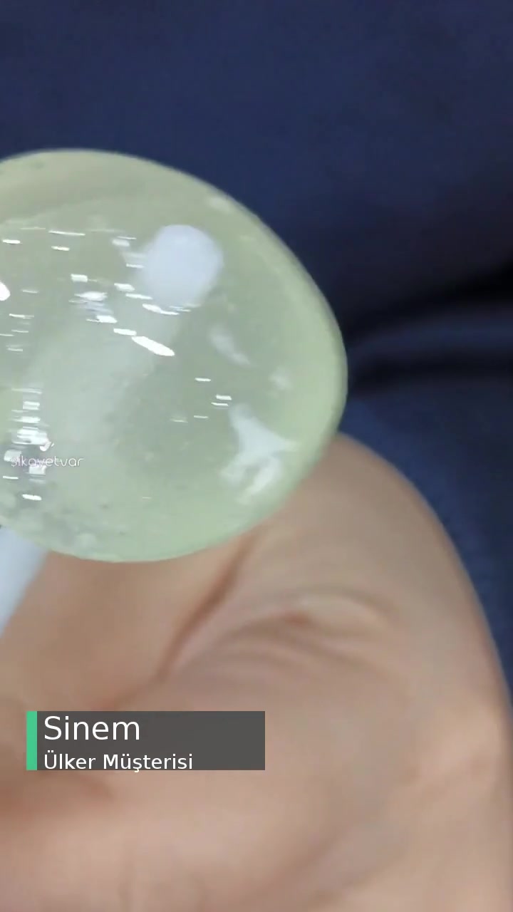 Ülker Yupo Şeker Sıkıntısı! videonun kapak resmi