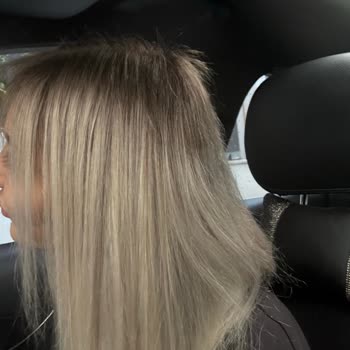 Kuaförde Yanlış Saç Rengi Ve Ciddi Saç Hasarı Nedeniyle Mağduriyet