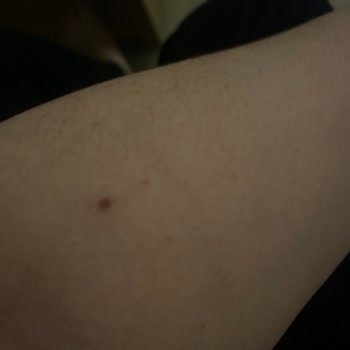 Velavit Probiyotik Kullanımı Sonrası Sağlık Sorunları Ve İade Talebim