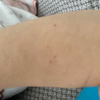 Velavit Probiyotik Kullanımı Sonrası Sağlık Sorunları Ve İade Talebim