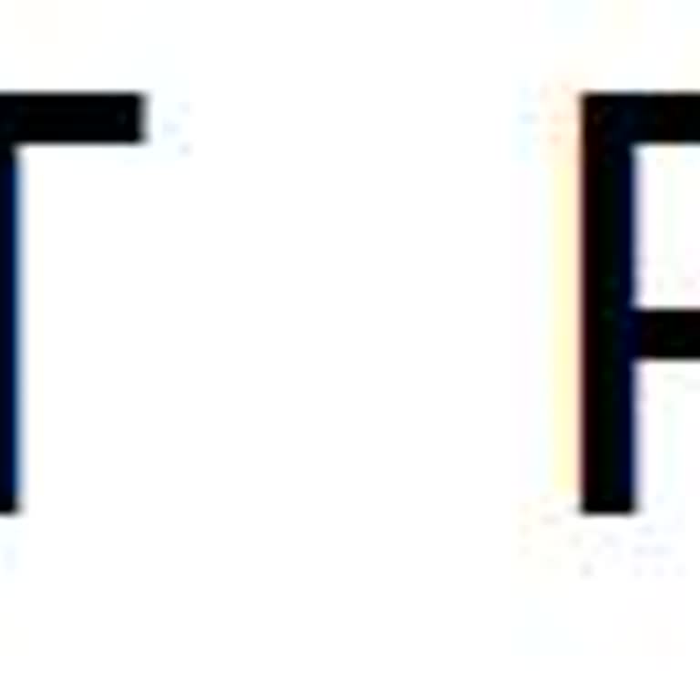 Sürekli Kesilen İnternet Ve Çözüm Sunulmayan Hizmet